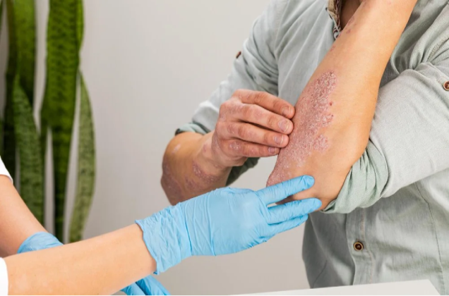 Allergy Center in Irving, TX