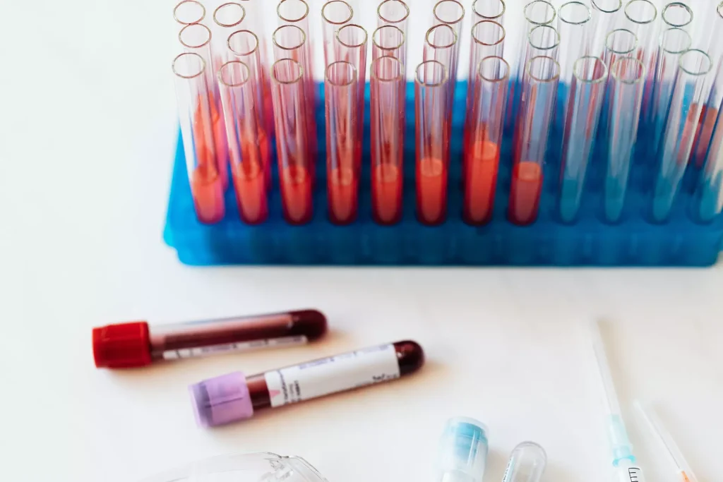 What You Can Learn from Your Blood Work