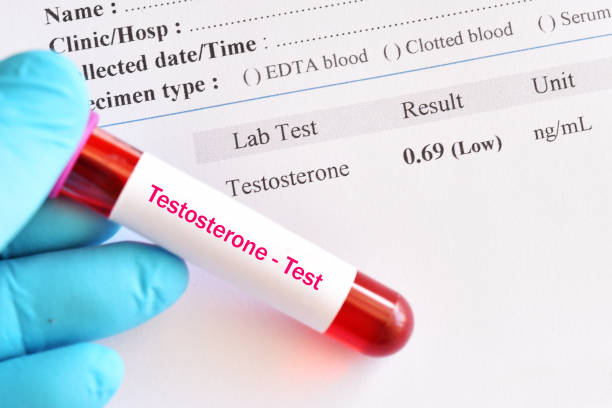How To Get Tested For Low Testosterone In Irving, TX